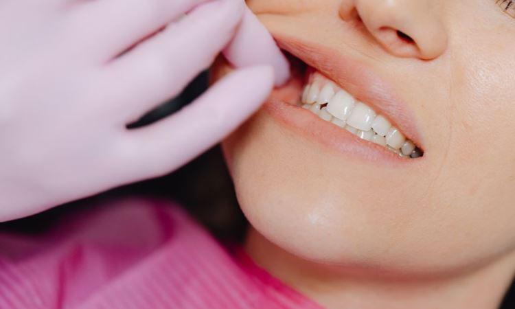 How To Prevent The Most Common Dental Problems?